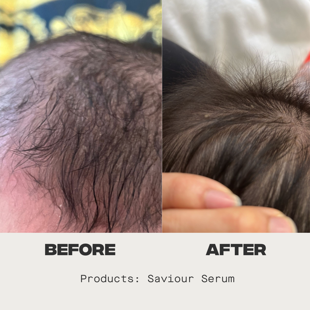 Saviour Serum