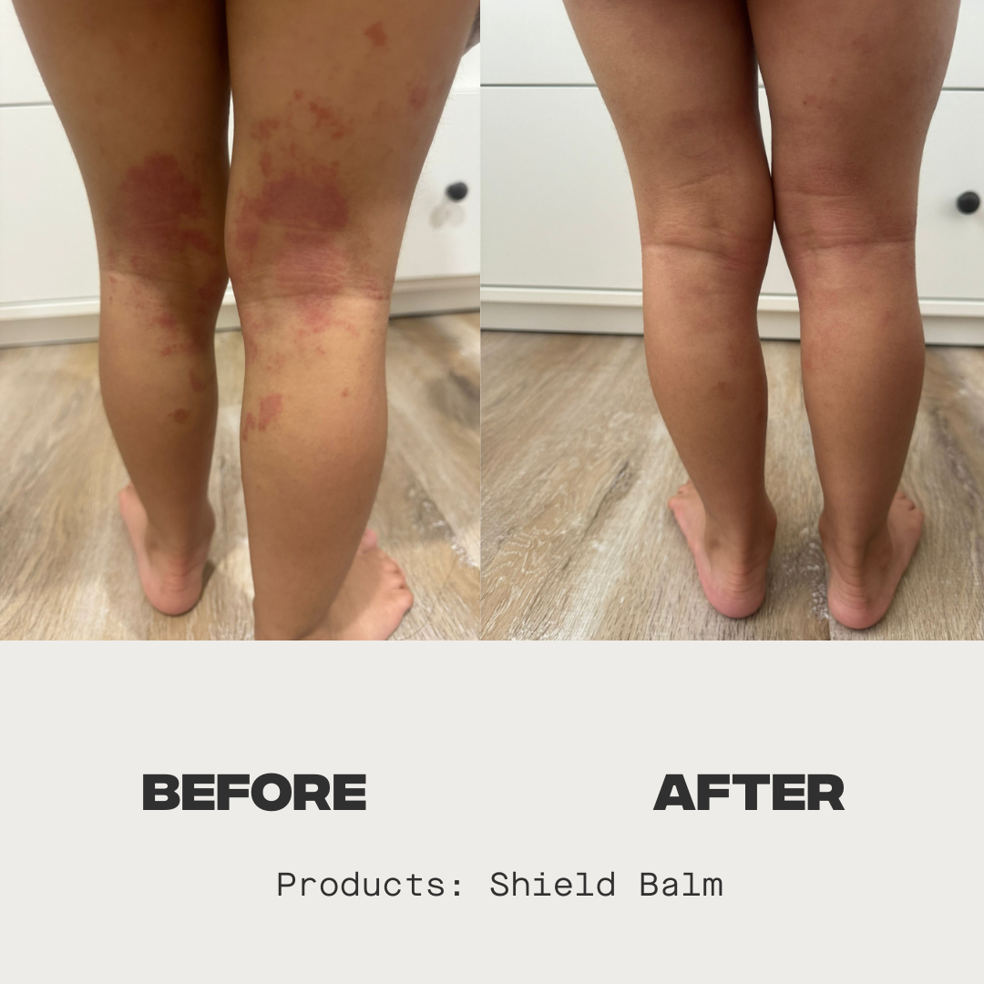 Shield Balm