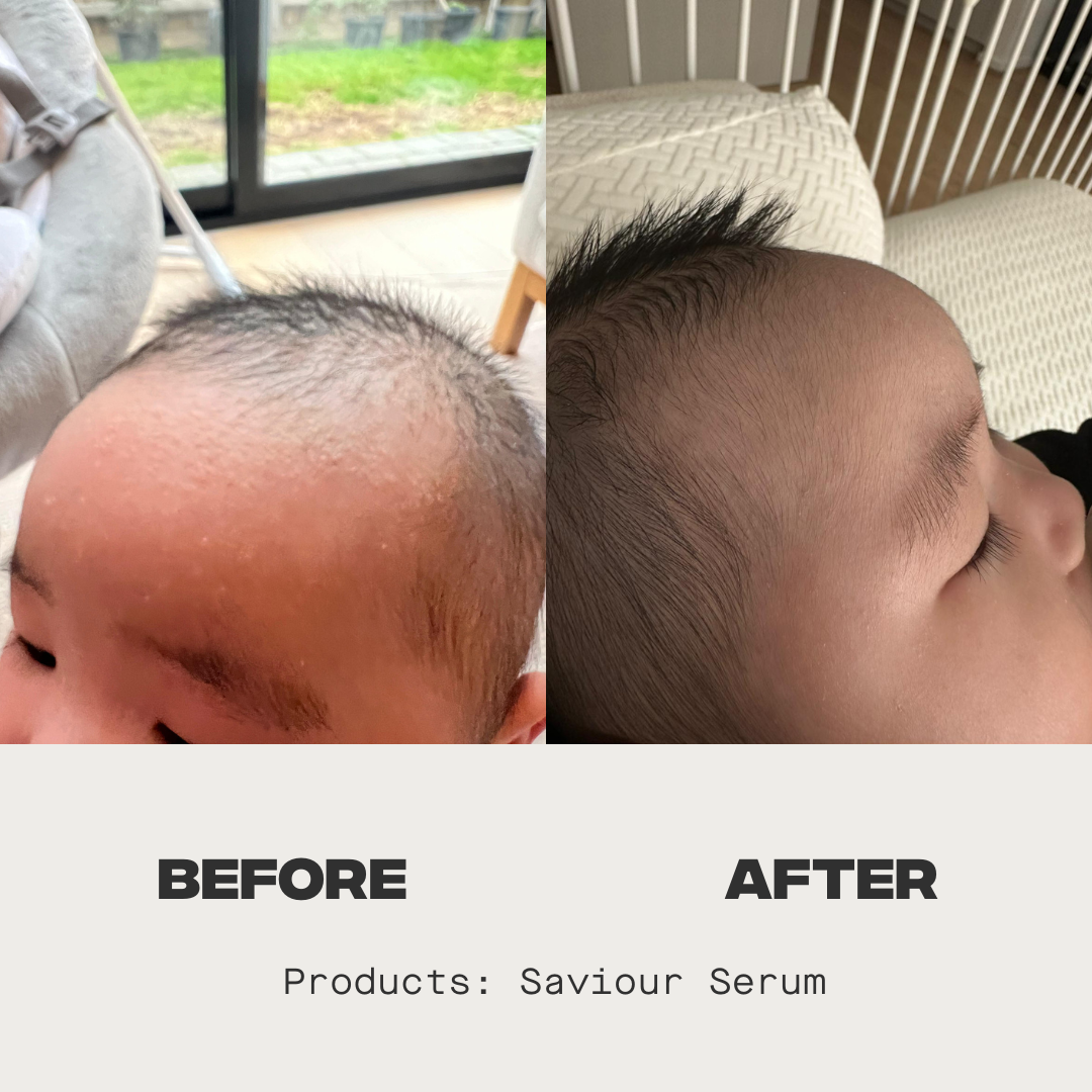 Saviour Serum