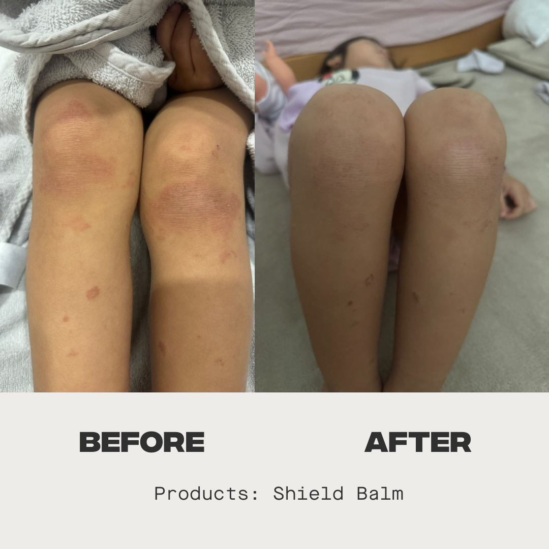 Shield Balm