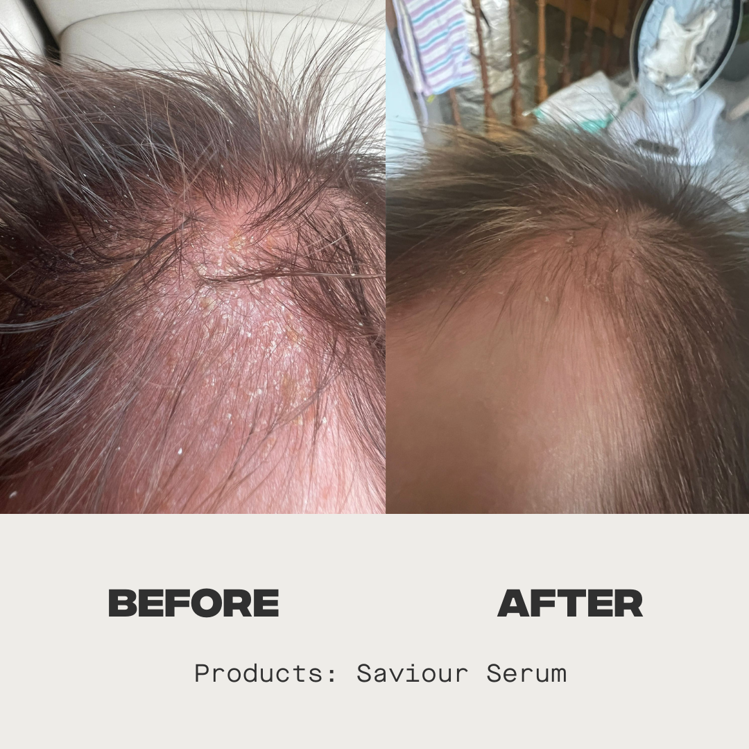 Saviour Serum