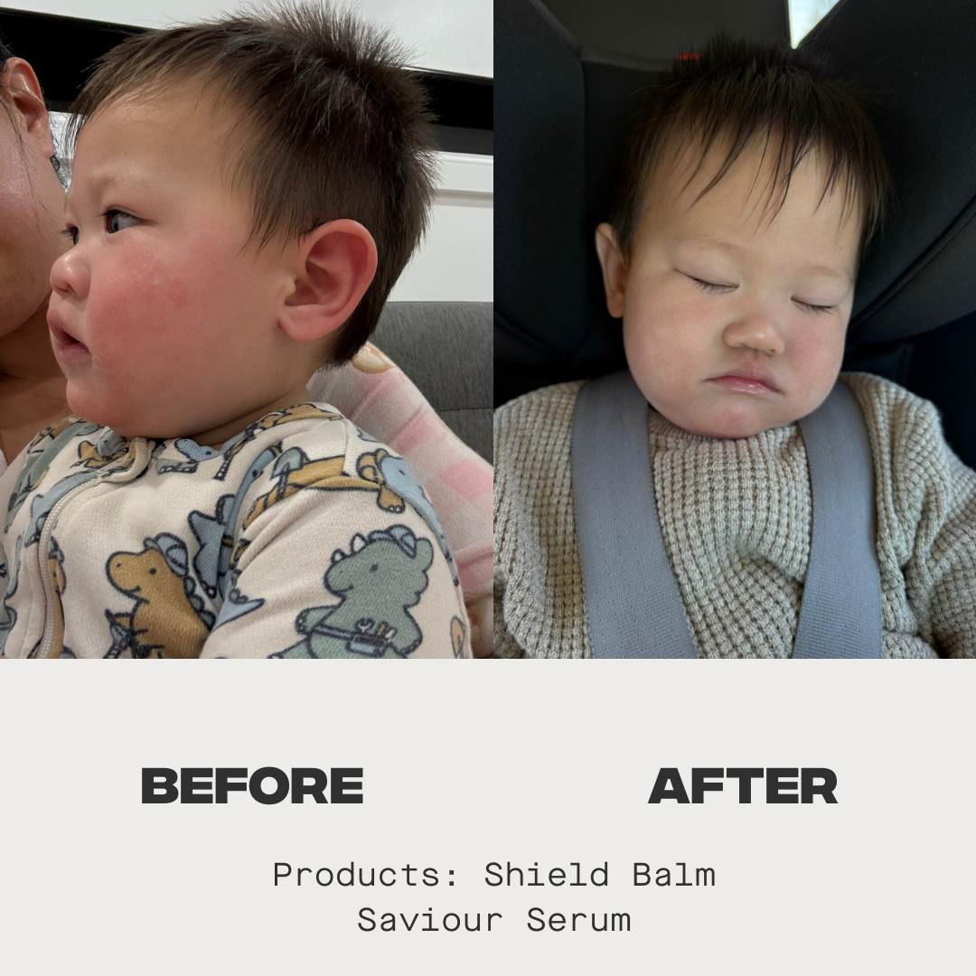Shield Balm