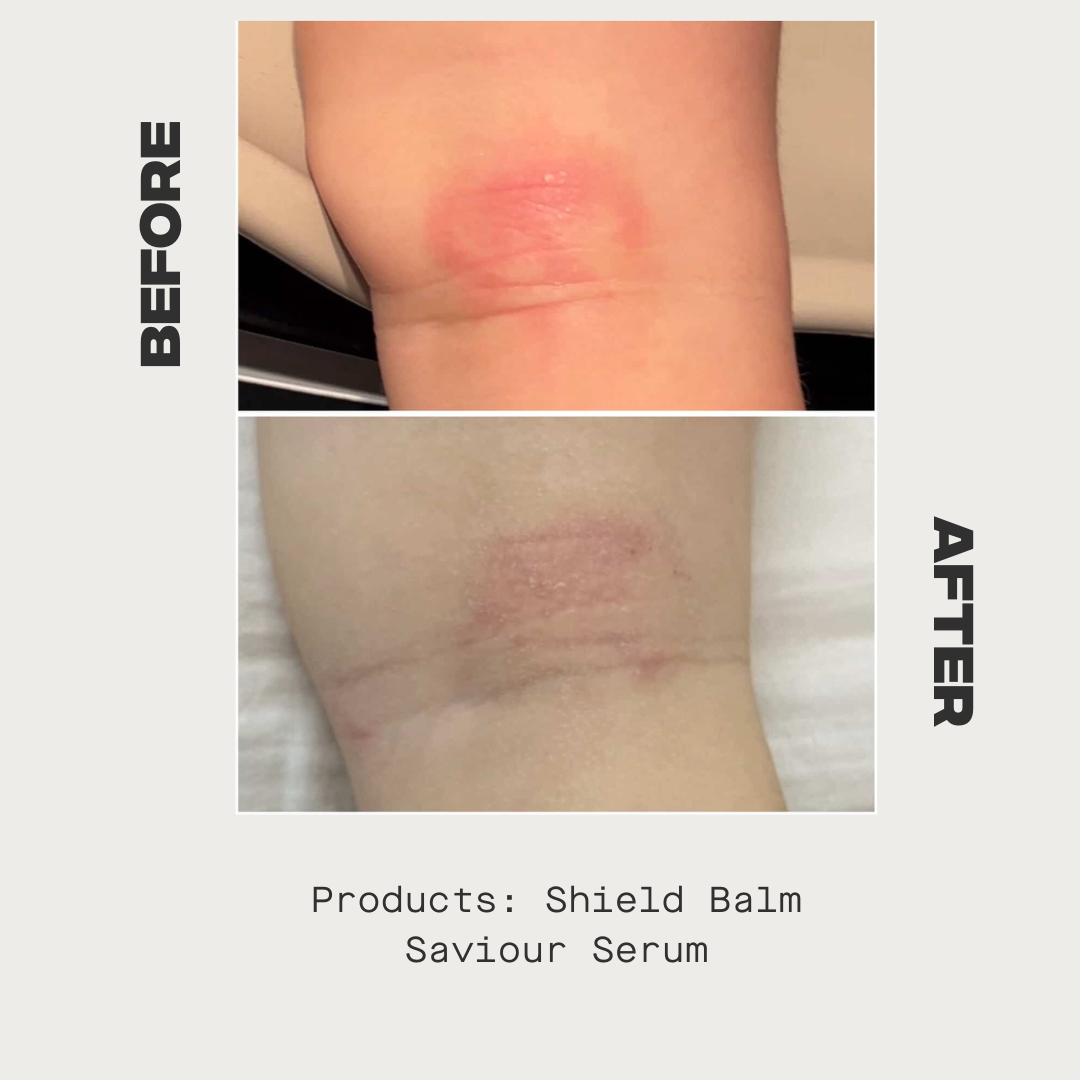 Shield Balm