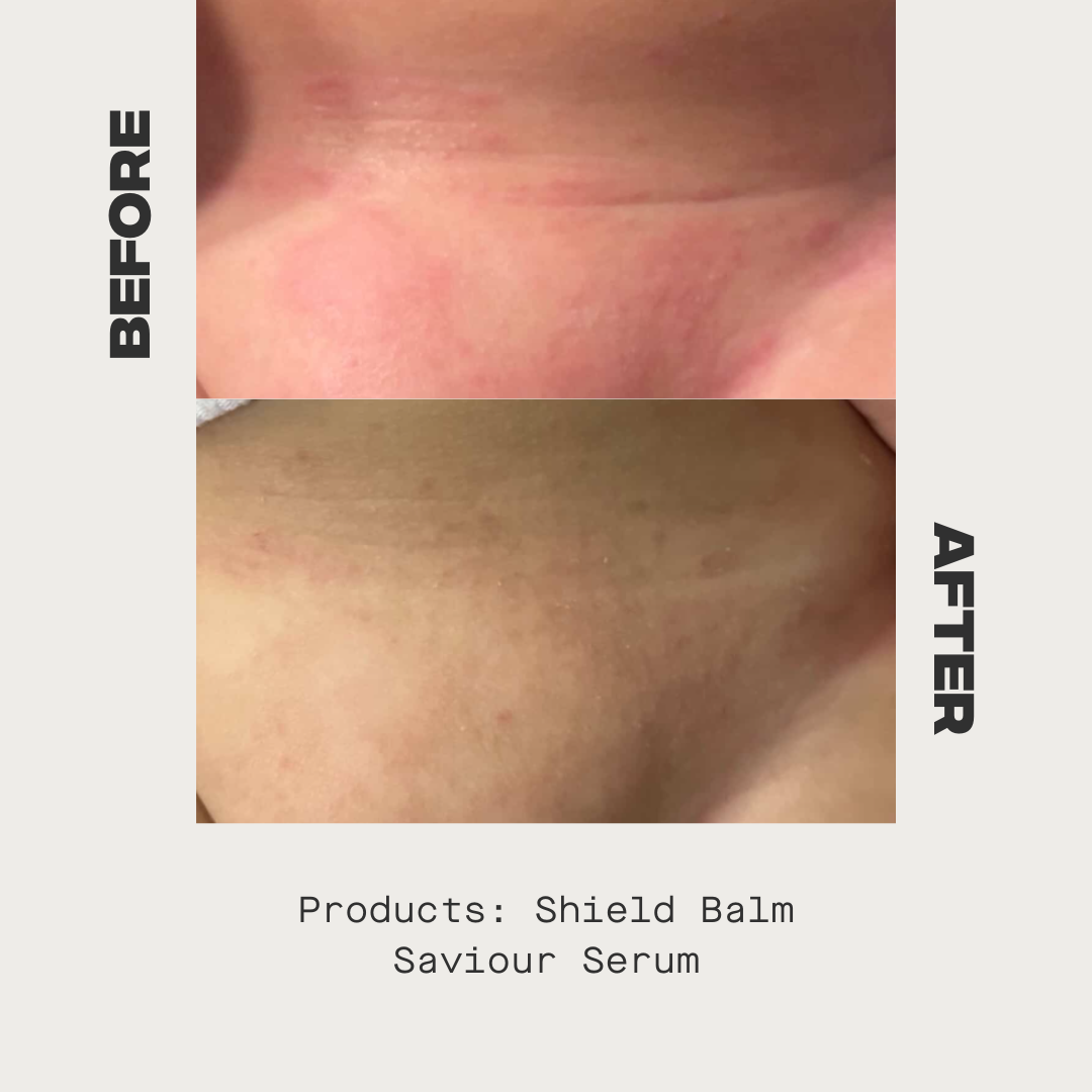 Shield Balm