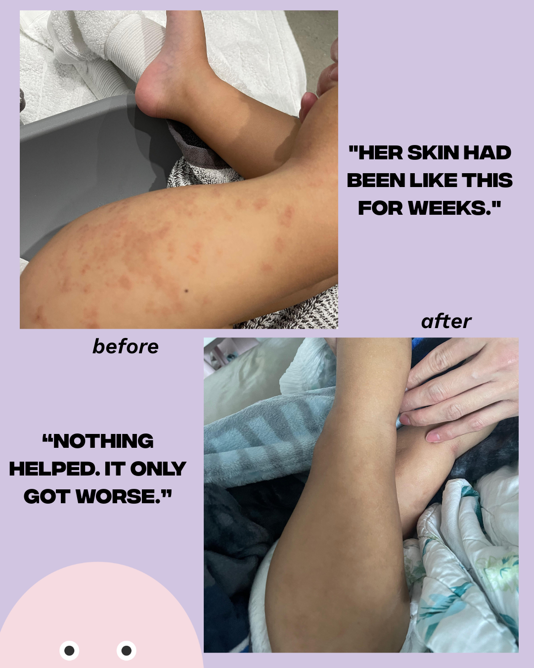 Shield Balm