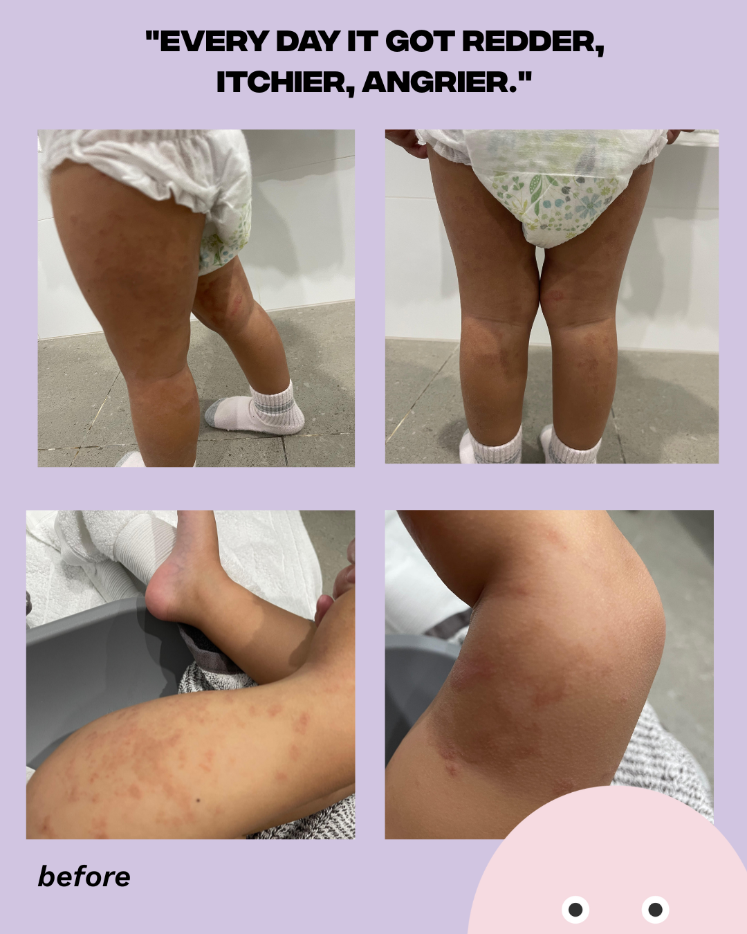 Shield Balm