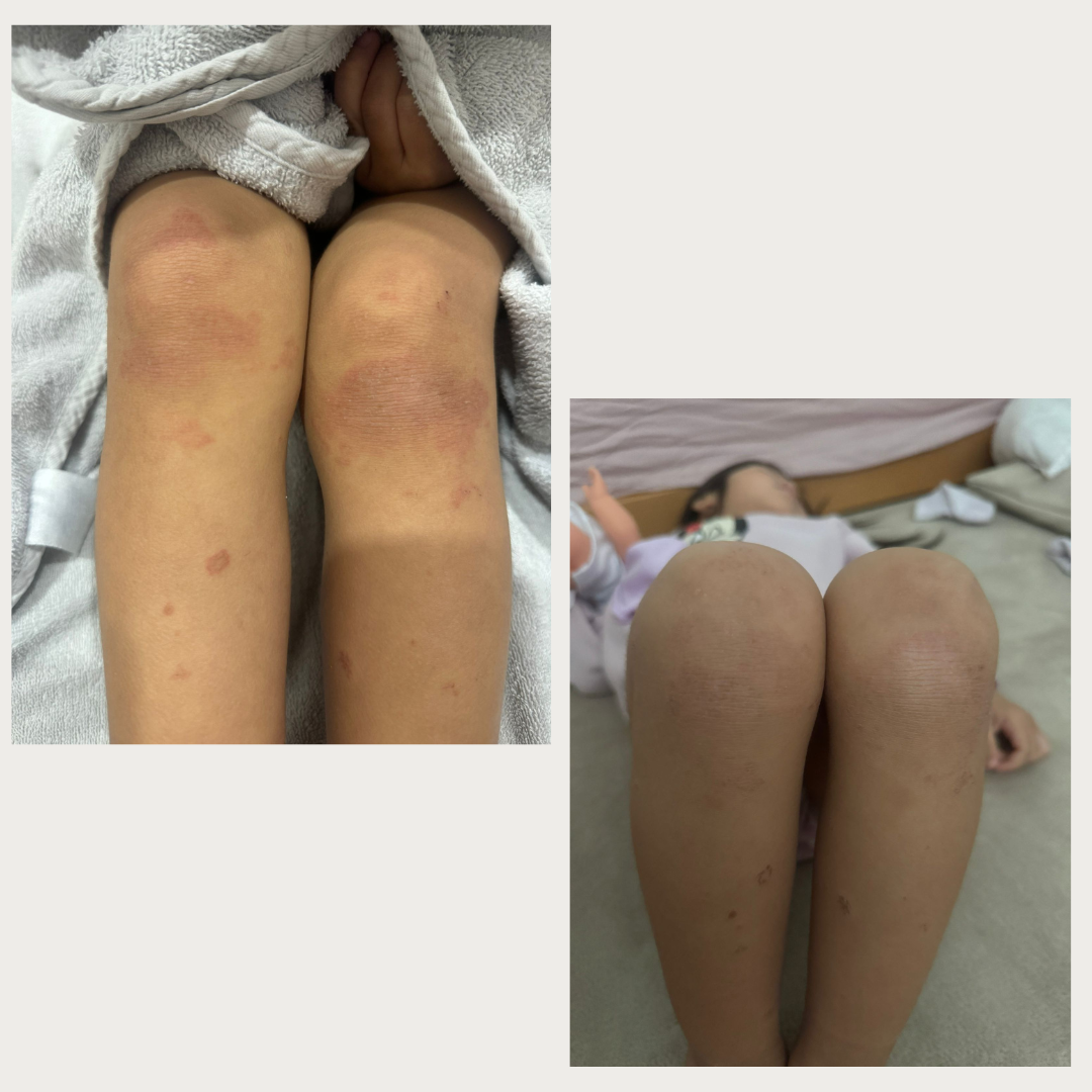 Shield Balm