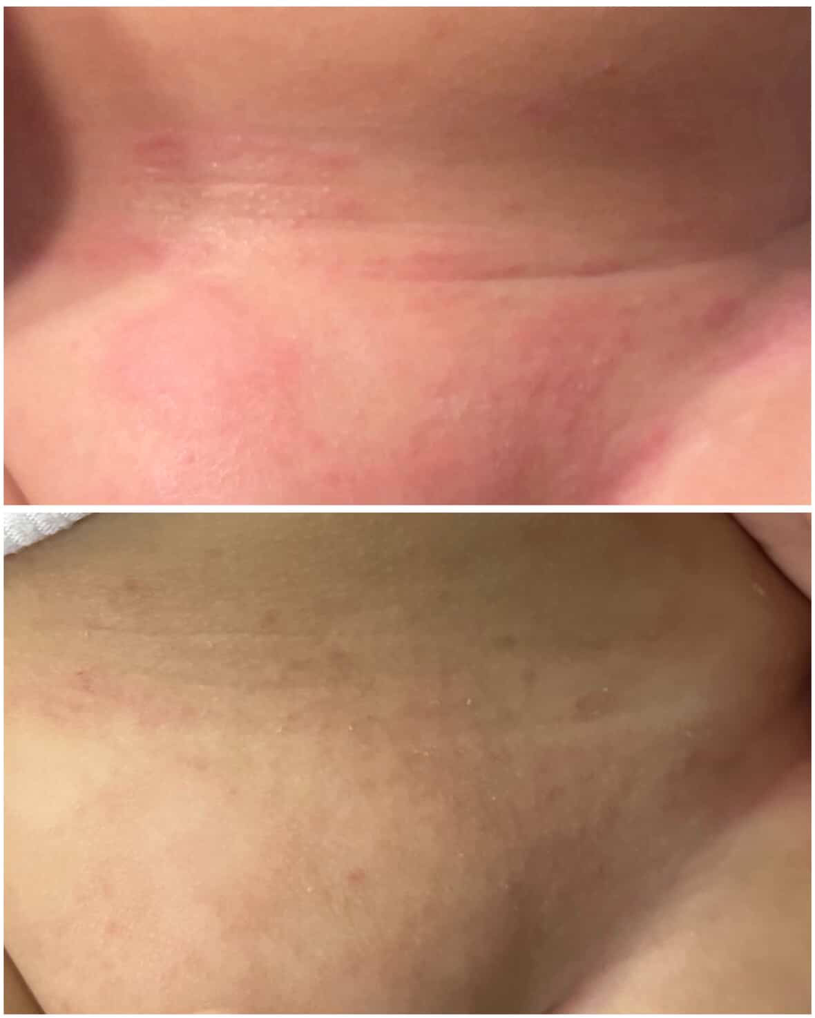 Shield Balm