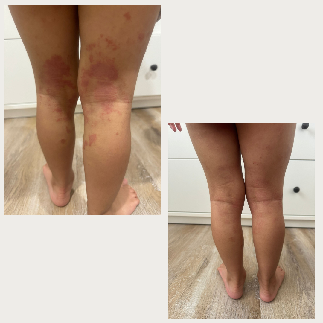 Shield Balm