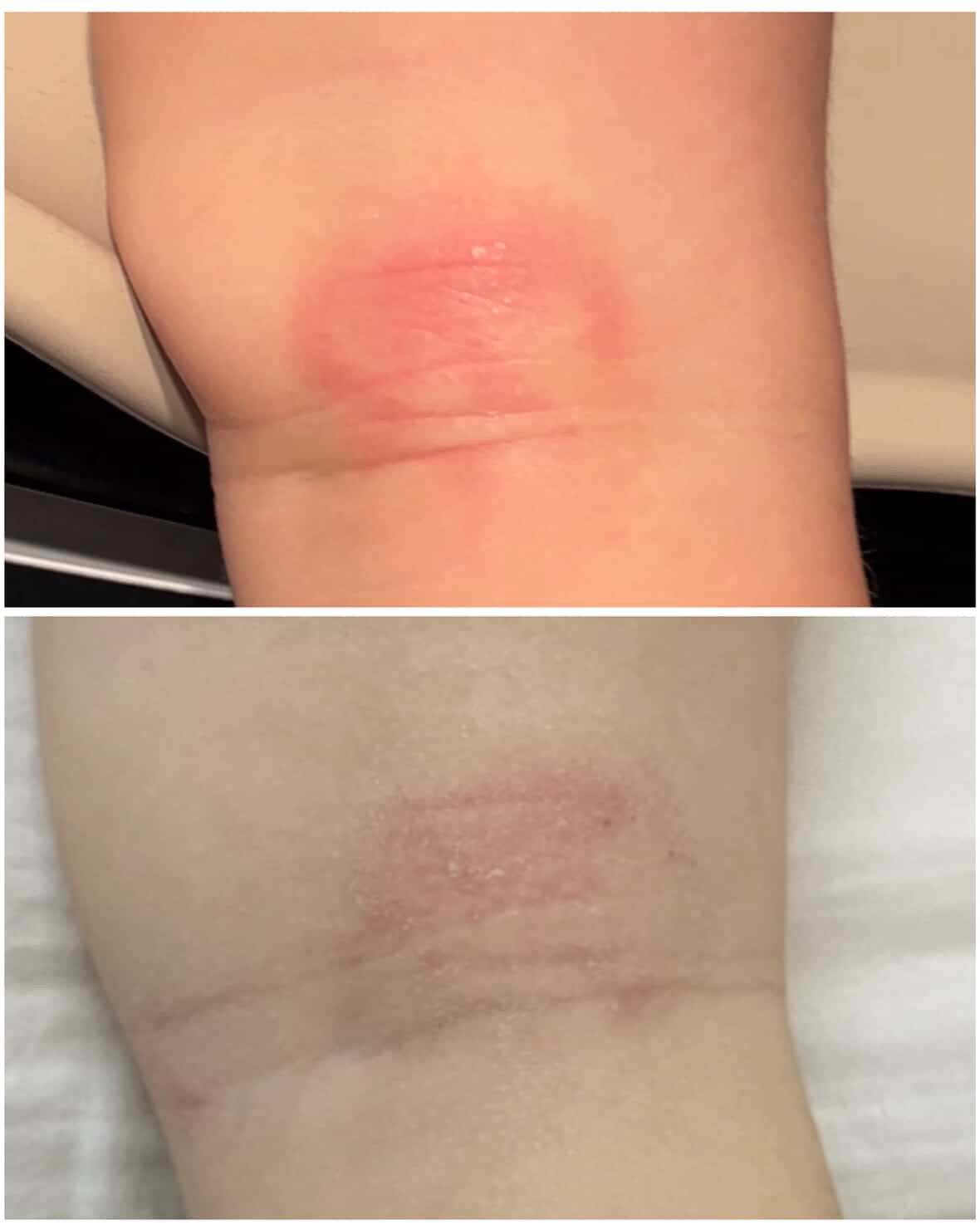 Shield Balm