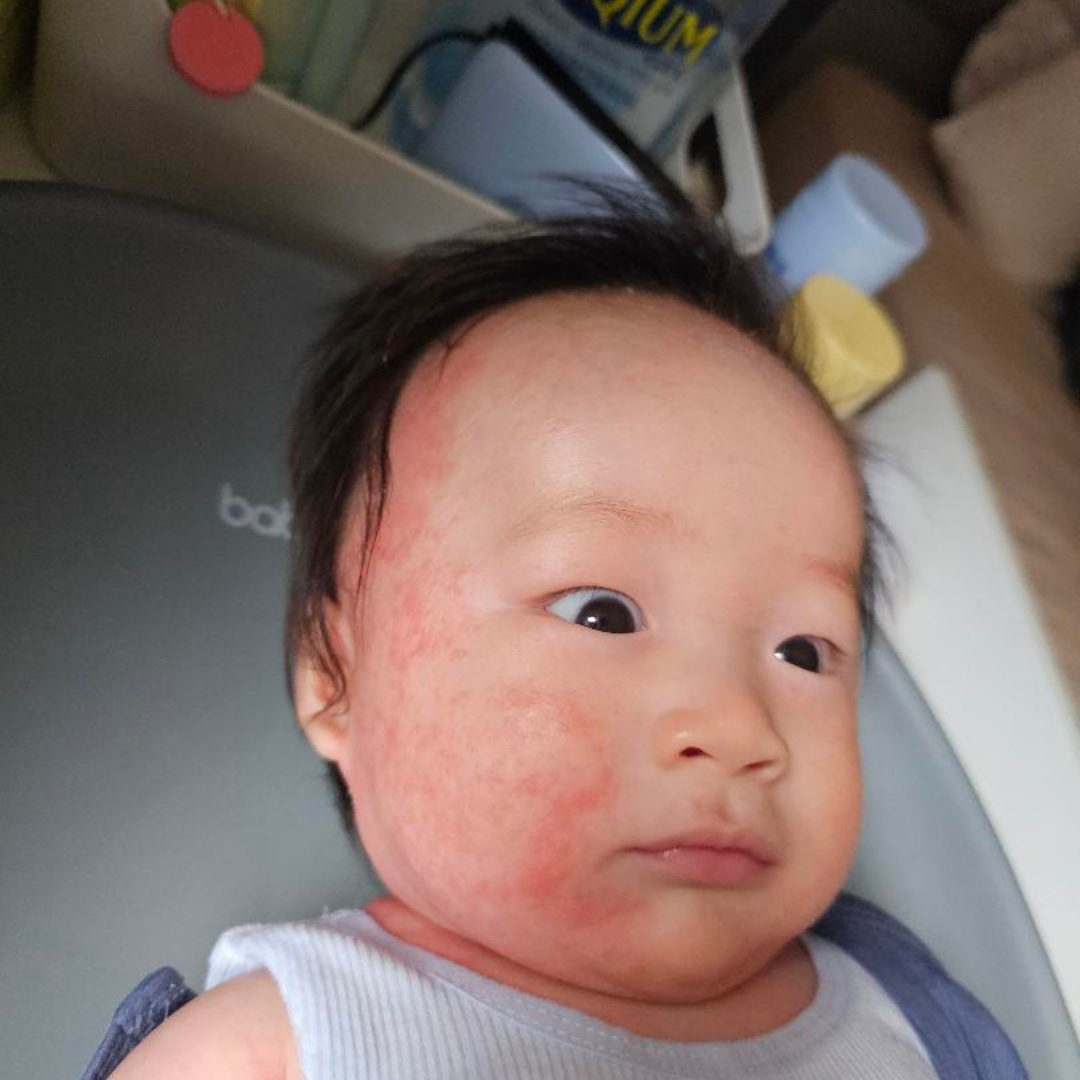 Before skin comparison