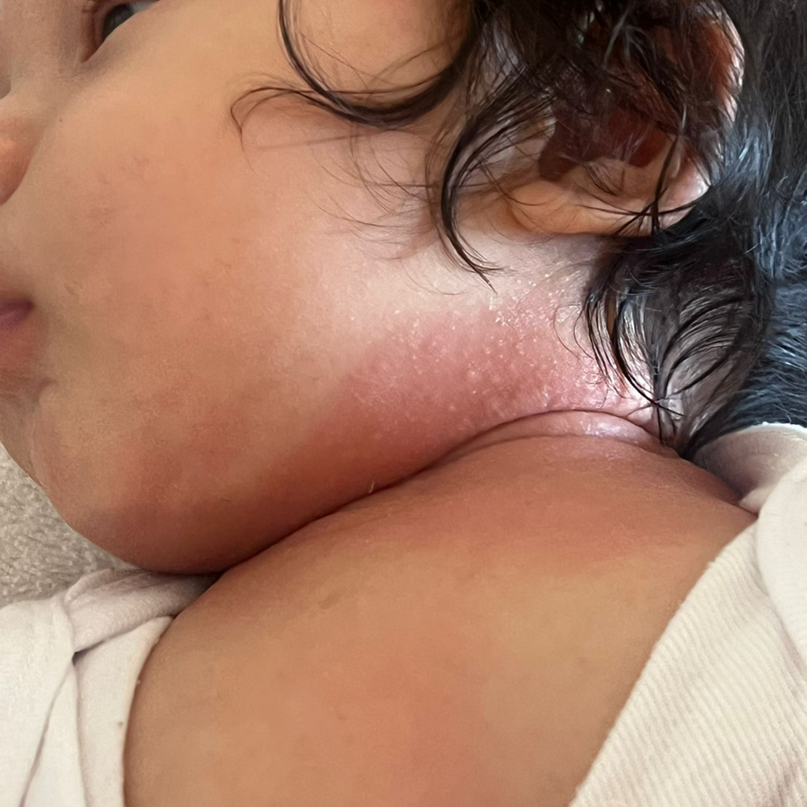 Before skincare results