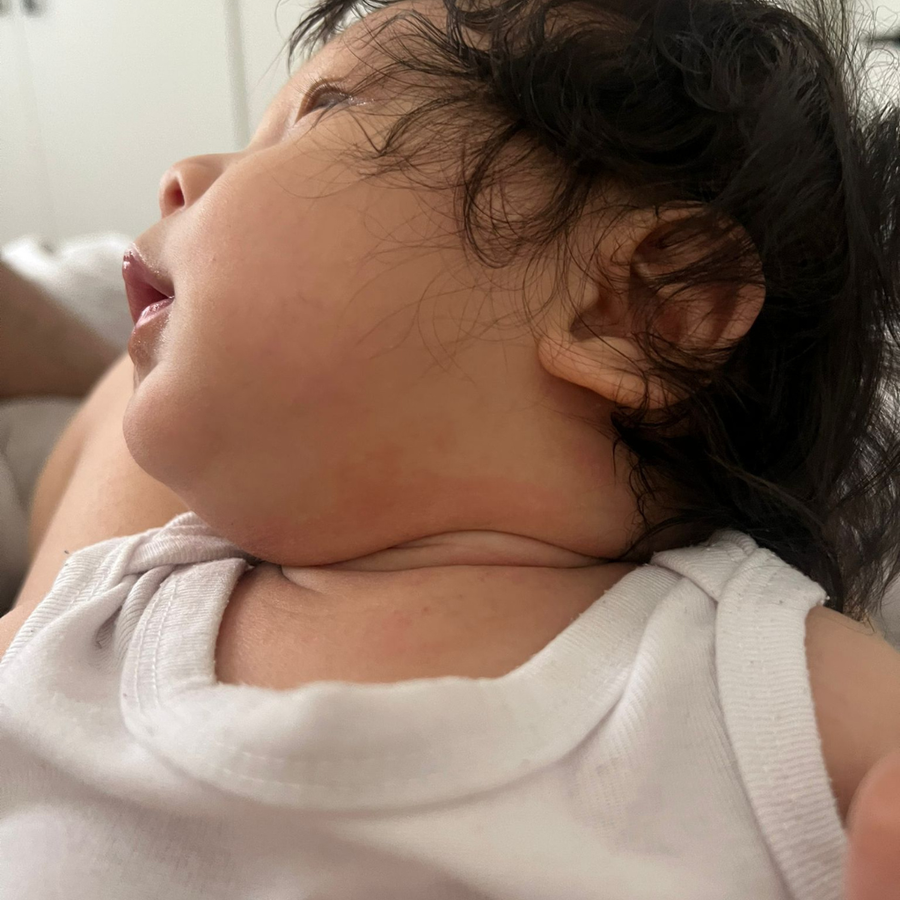 After skincare results