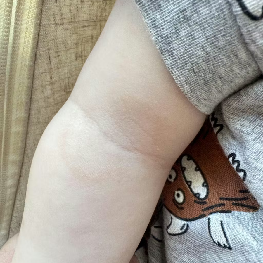 After skincare results