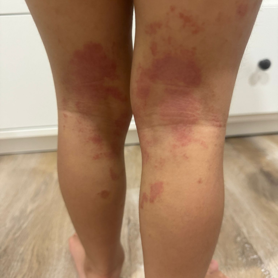 Before skincare results